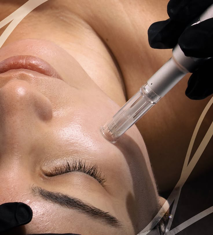 PROTOCOLO ANTIAGE CON DERMAPEN